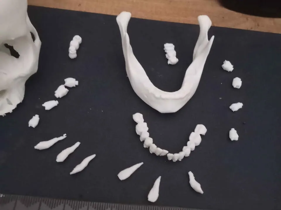 Improved support structures for the lower jaw - 3D printed People, in stock in India